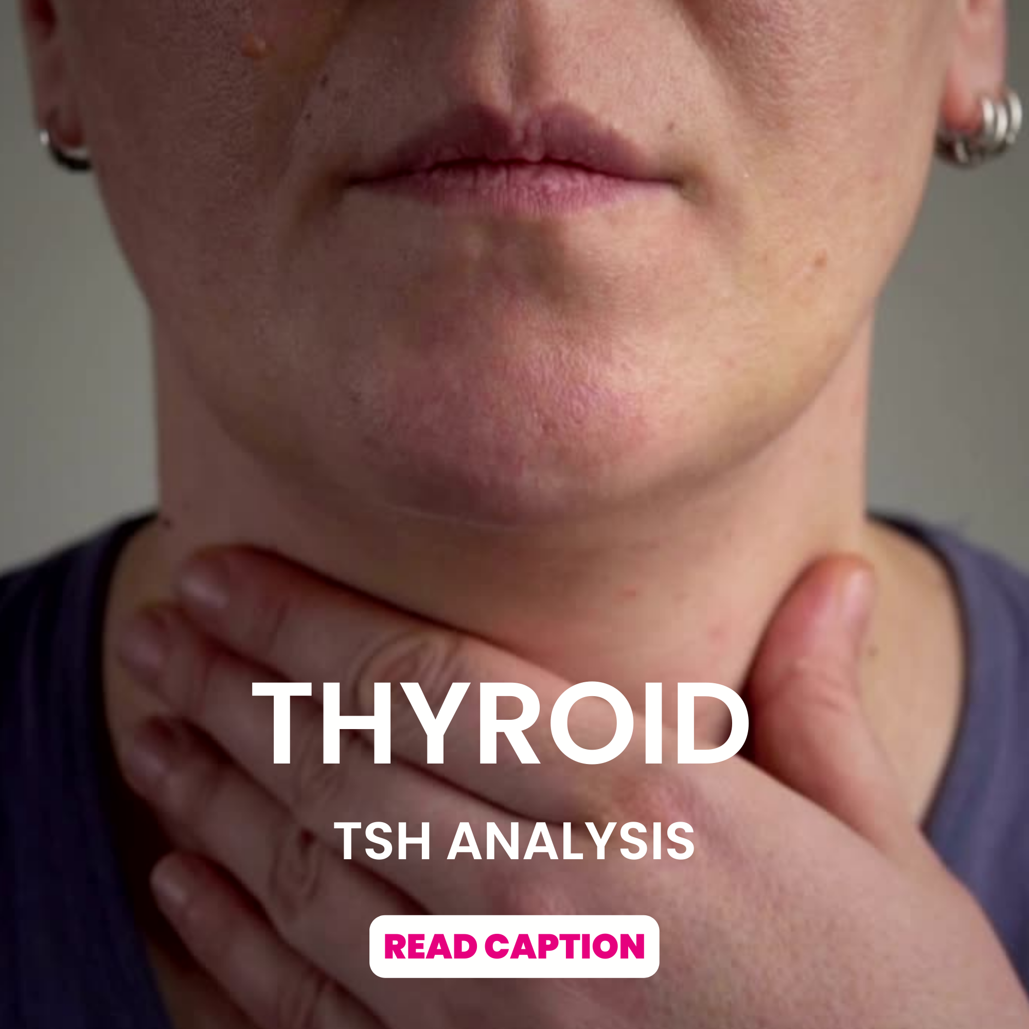 Did you know that women are more likely to have thyroid problems than men?